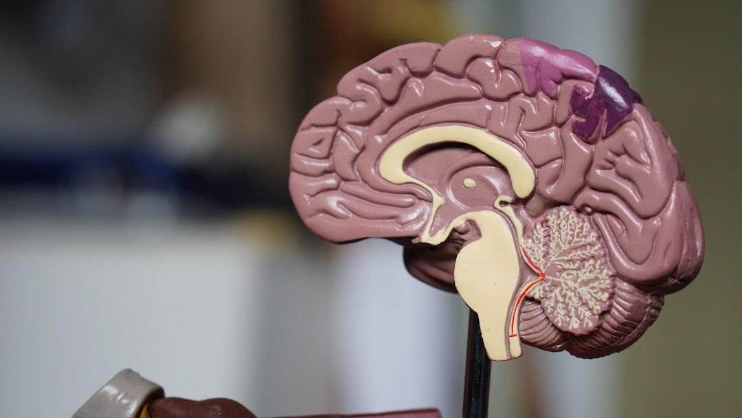 (EXTRA) Brain Boost